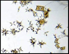diatoms under microscope