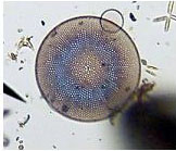 Diatom