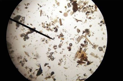 Variety of Plankton
